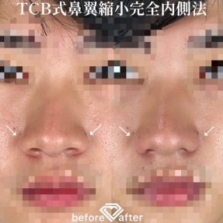 症例写真