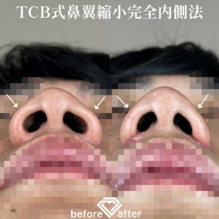 症例写真