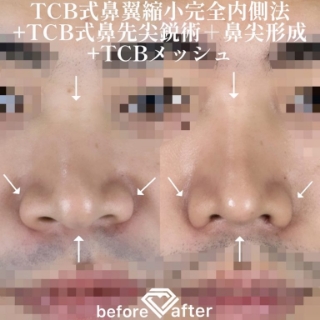 症例写真