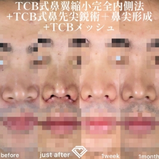 症例写真