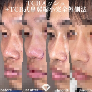 症例写真