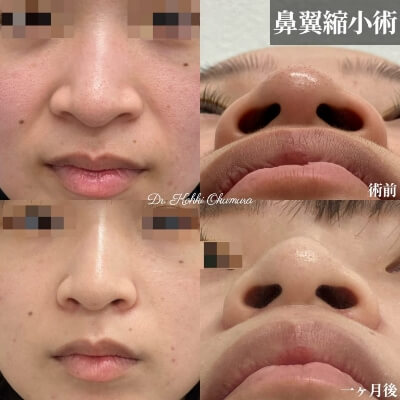 症例写真