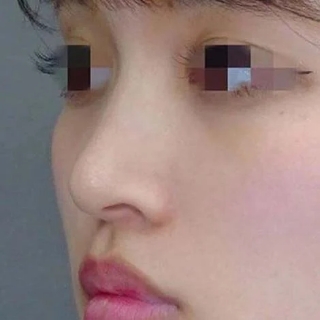 症例写真