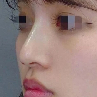 症例写真
