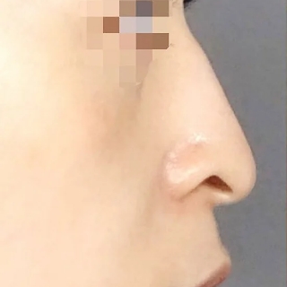 症例写真
