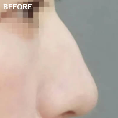 症例写真