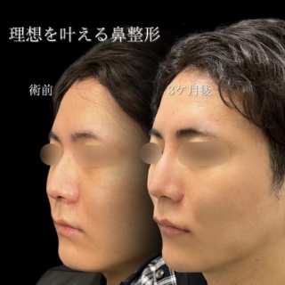 症例写真