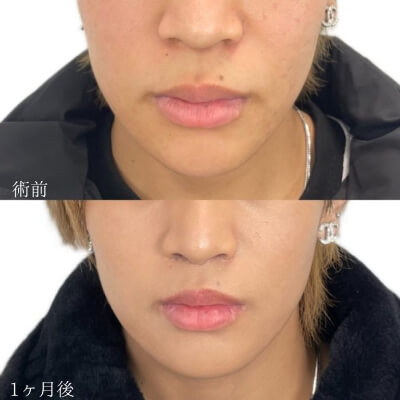 症例写真