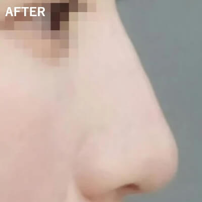 症例写真