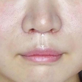 症例写真
