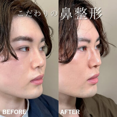 症例写真