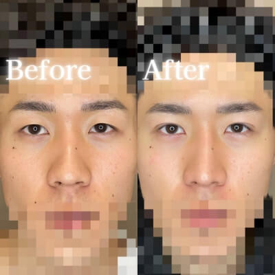 症例写真