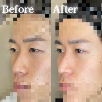 症例写真