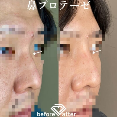 症例写真