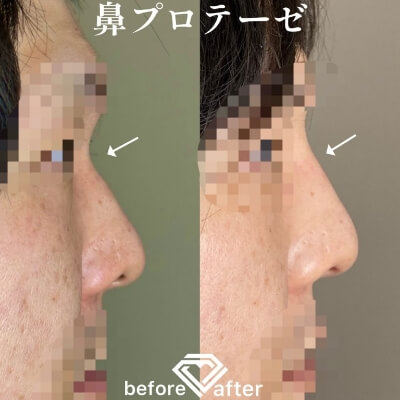 症例写真