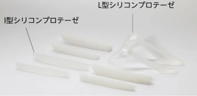 プロテーゼーとは