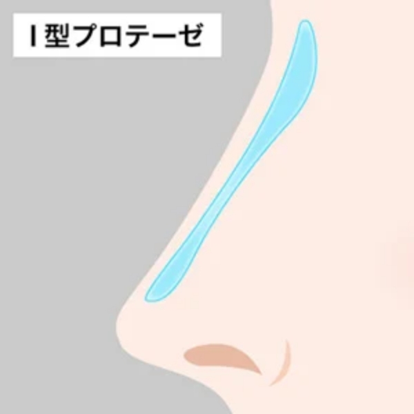 TCBではI型のプロテーゼを使用