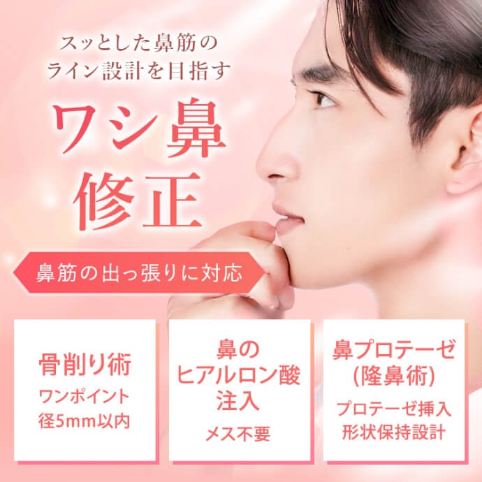 ワシ鼻修正