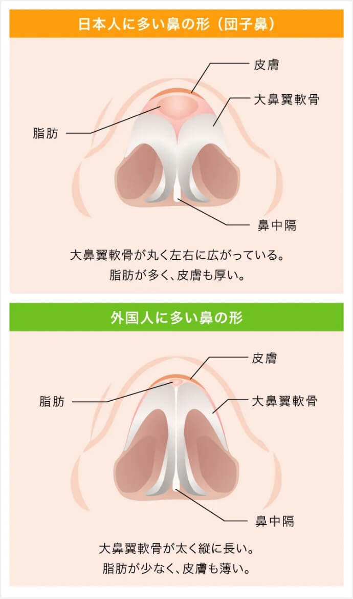 鼻尖形成完全閉鎖法が選ばれている理由