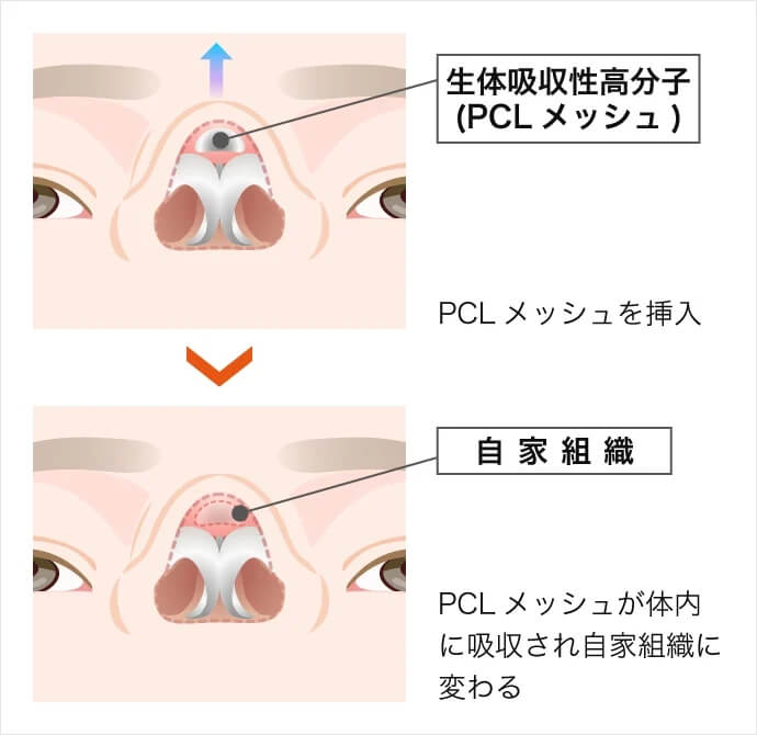 PCLメッシュとは
