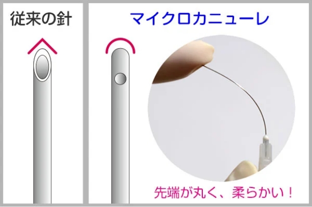 マイクロカニューレは先端が丸く、柔らかい！
