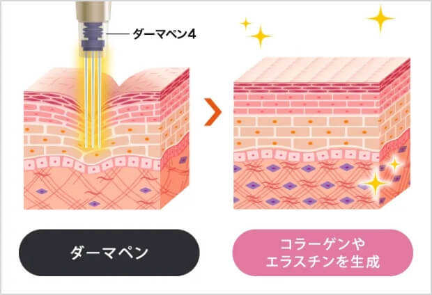 肌の弾力・小じわ