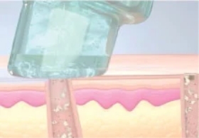 ディープクレンジング＋保湿