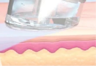 保護美容成分をお肌に浸透させ潤いを保ち整った肌環境に。