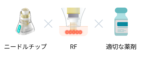 ニードルチップ×RF×適切な薬剤
