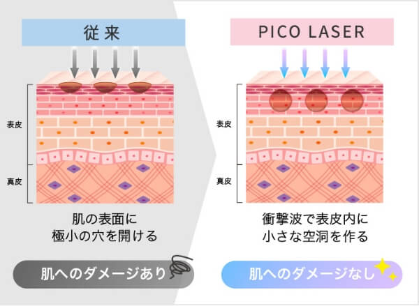 ピコフラクショナル