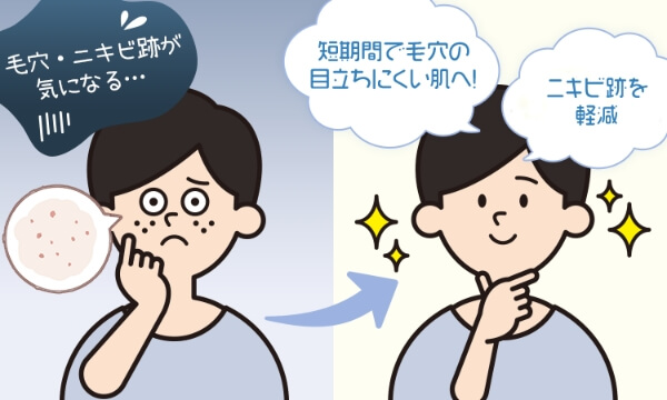 ダウンタイムほぼなし！