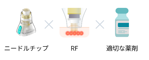 ニードルチップ ✕ RF ✕ 適切な薬剤
