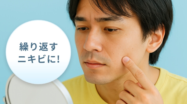 ニキビケア・再発予防