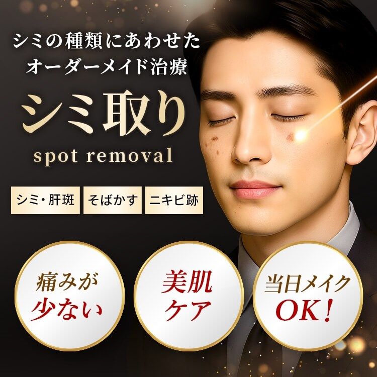 シミ取り