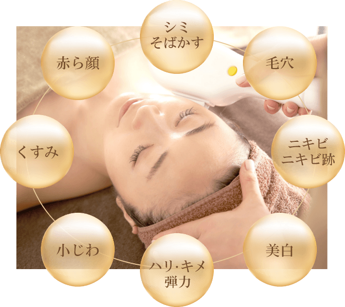 IPL光治療とは？