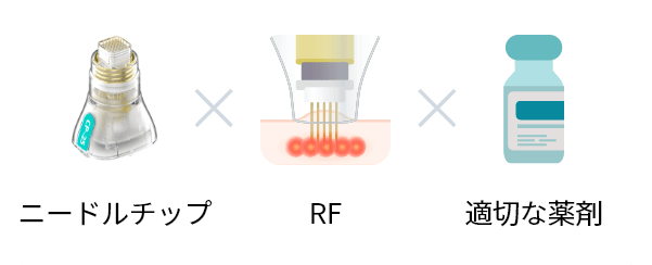 ニードルチップ ✕ RF ✕ 適切な薬剤