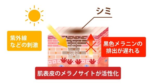 そもそもシミとは？