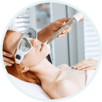 フラクショナルレーザー