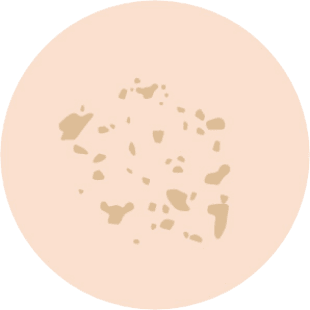 そばかす(雀卵班)