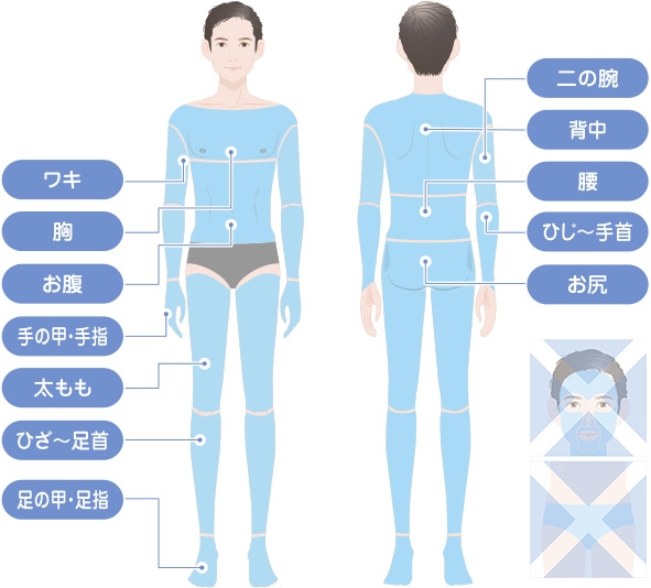 全身脱毛（クイック脱毛）