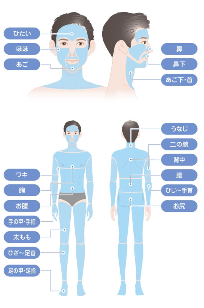 TCBの医療脱毛で施術可能な部位一覧
